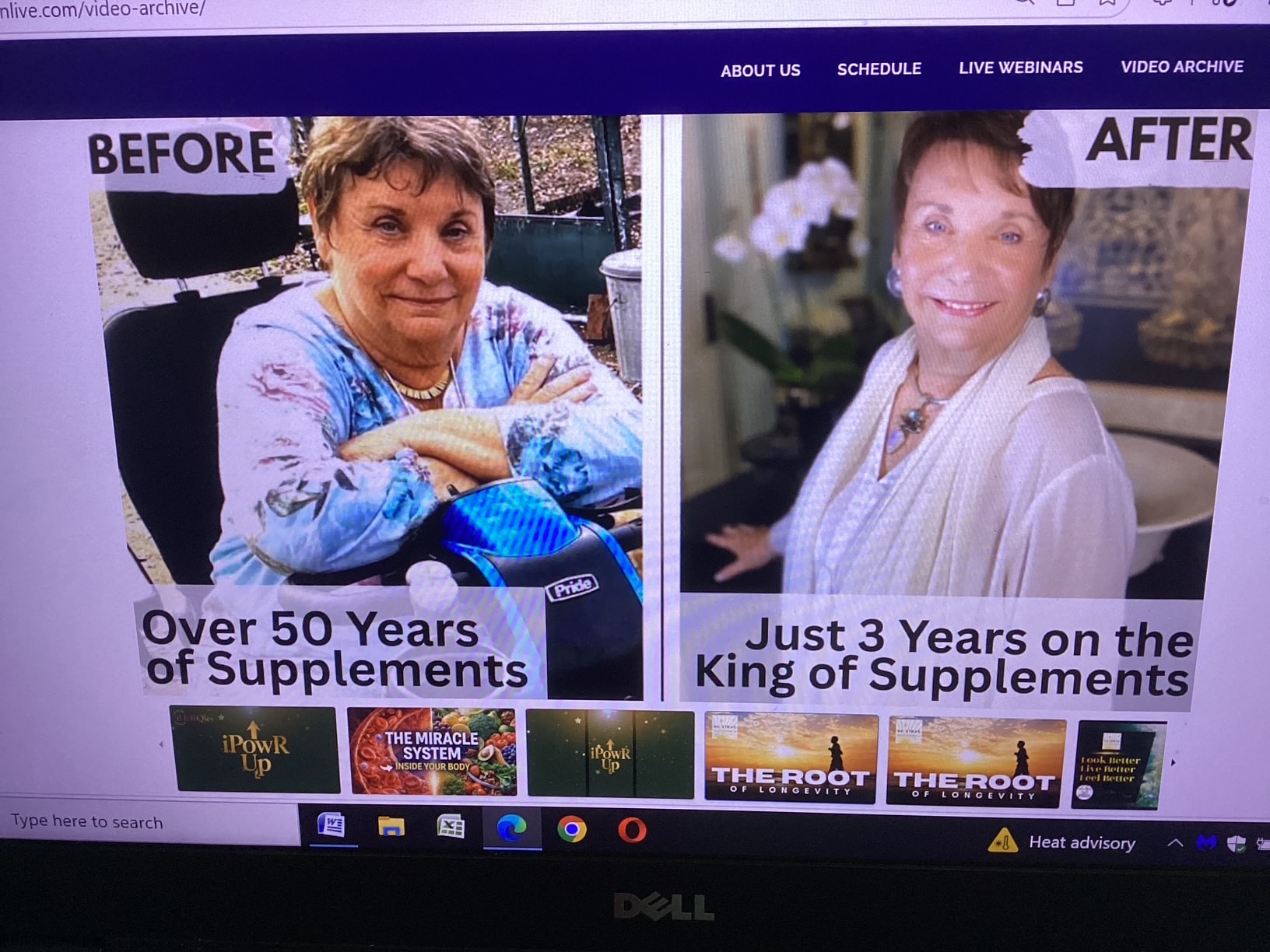 Kare's before and after testimonial photo after taking iHerQles for 3 years